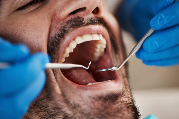 Best Walk-In Emergency Dentist in Farmersburg, IN